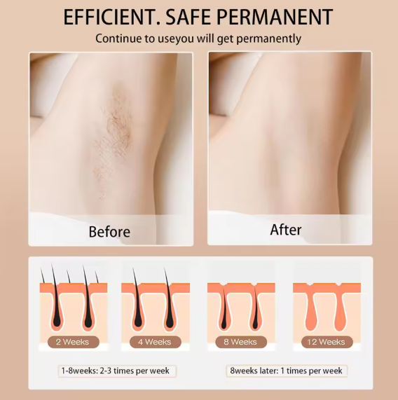 Digital IPL Hair Removal Device TrendyZone